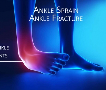 Ankle sprain or fracture is one of the most common of all injuries